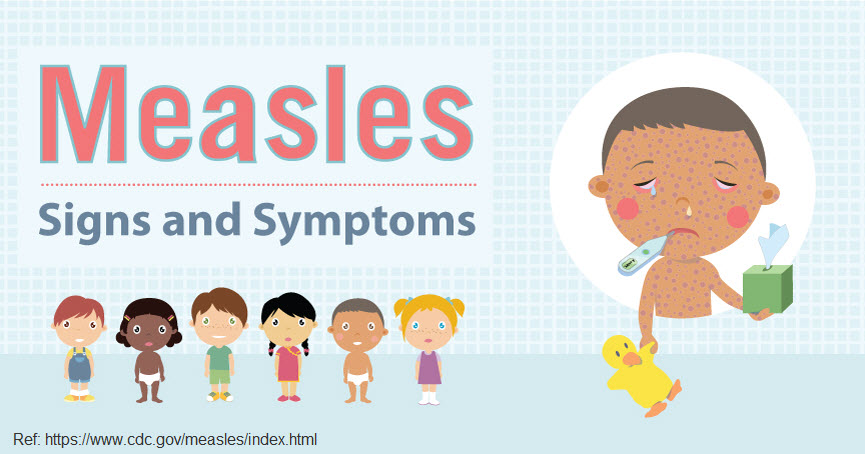 Measles